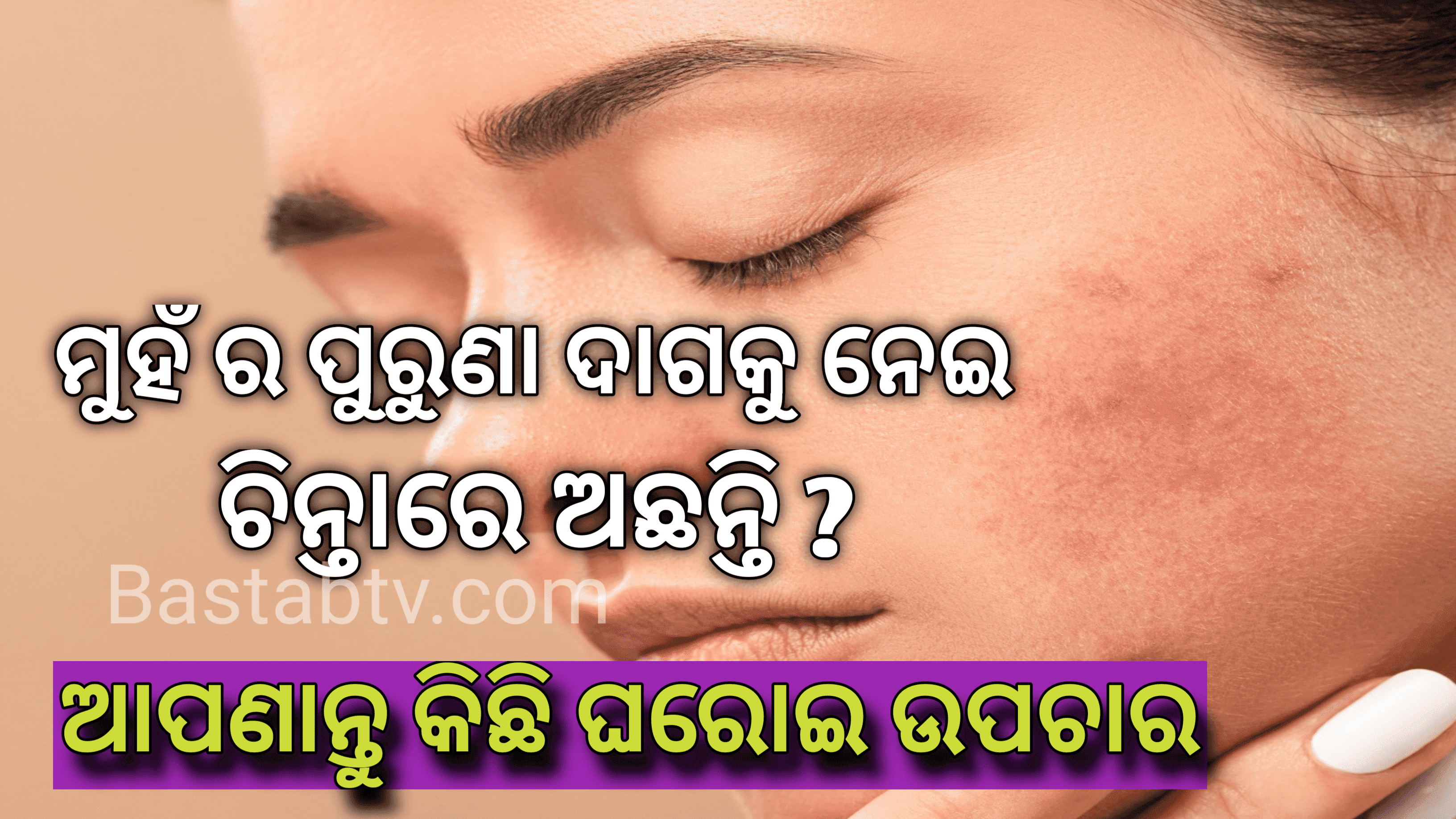 ମୁହଁର ପୁରୁଣା ଦାଗକୁ ନେଇ ଚିନ୍ତାରେ ଅଛନ୍ତି ?ଆପଣାନ୍ତୁ  କିଛି ଘରୋଇ ଉପଚାର ….